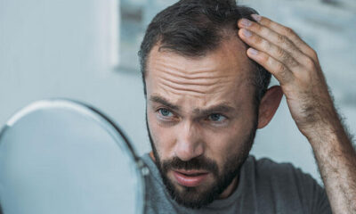 Hasan Akıl: Koronavirüs saç ekimine talep oluşturdu