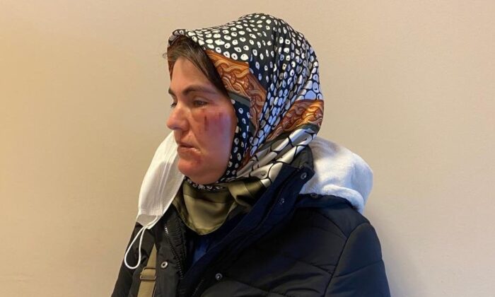 İstanbul’da sokak ortasında kadına saldırı: Kendimi yerlerde buldum