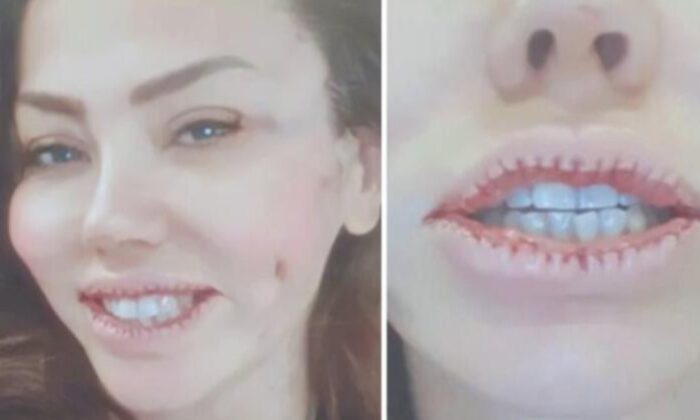 Lara, dudaklarını küçülttü