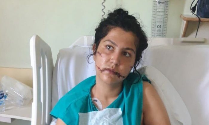 104 yerinden bıçaklandı kabusu bitmedi: Pencereye bile çıkamıyorum